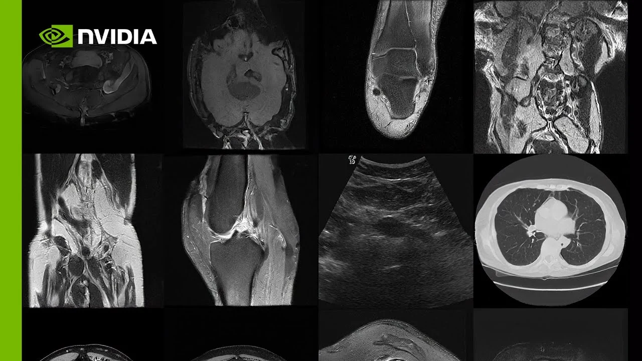 MONAI medical imaging AI cloud service introduced by NVIDIA